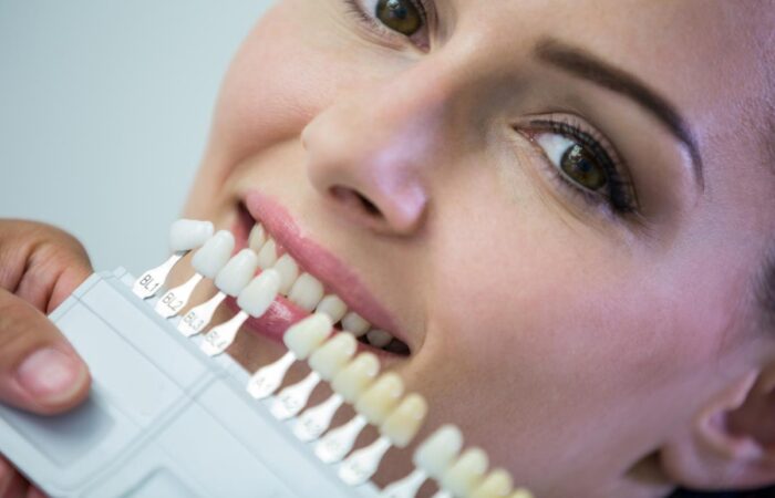 Zirkonyum ve porselen diş kaplama farklarını gösteren diş modeli görseli