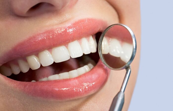 Estetik gülüş tasarımı için diş ve yüz analizinin yapıldığı dental değerlendirme görüntüsü.