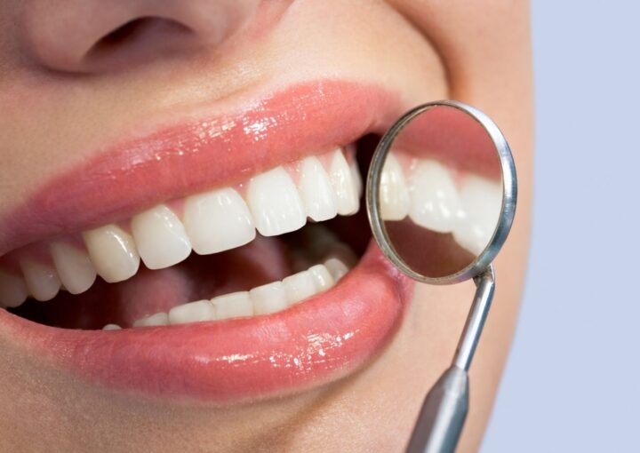 Estetik gülüş tasarımı için diş ve yüz analizinin yapıldığı dental değerlendirme görüntüsü.