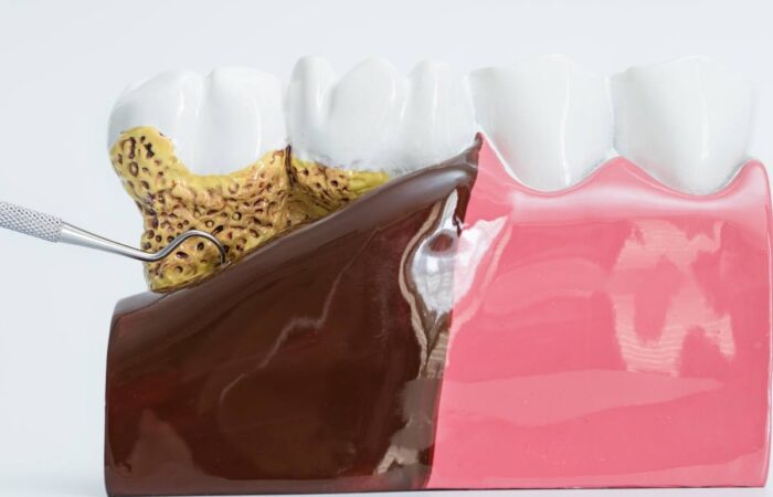 Diş eti iltihabı ve kalp sağlığı ilişkisini anlatan ağız içi ve dolaşım temalı tıbbi görsel.