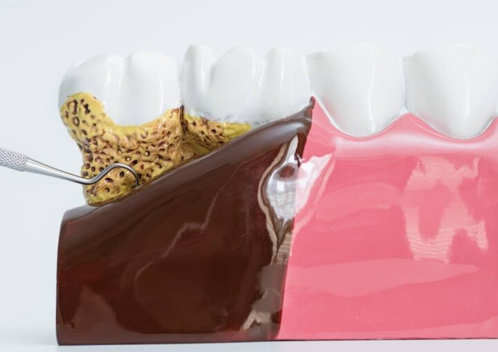 Diş eti iltihabı ve kalp sağlığı ilişkisini anlatan ağız içi ve dolaşım temalı tıbbi görsel.