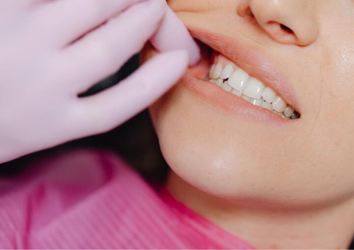 Diş sıkmaya bağlı çene kaslarında gerginlik yaşayan bir bireyin yüz kası değerlendirme görüntüsü.