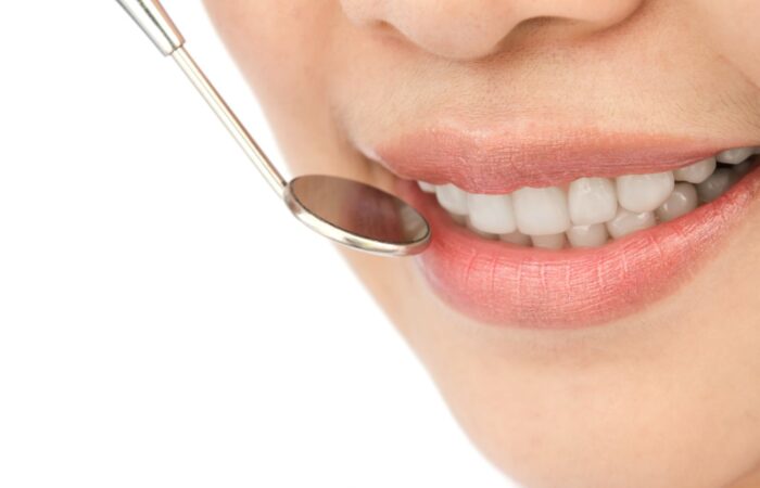 Ön diş estetiği sonrası doğal ve uyumlu diş görünümünü gösteren estetik diş hekimliği görseli.