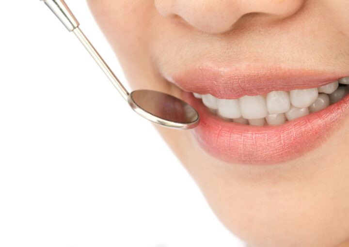 Ön diş estetiği sonrası doğal ve uyumlu diş görünümünü gösteren estetik diş hekimliği görseli.