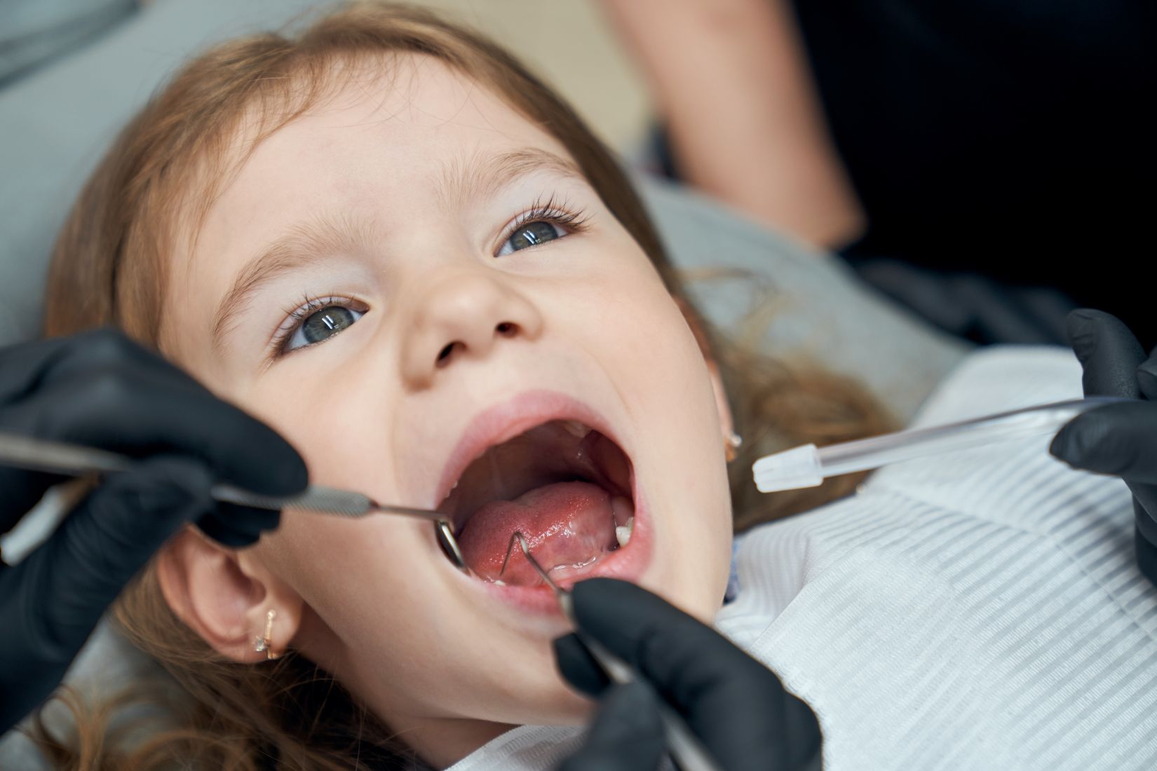 Sedasyon altında çocuk diş tedavisi sürecini temsil eden çocuk diş hekimliği klinik görseli.
