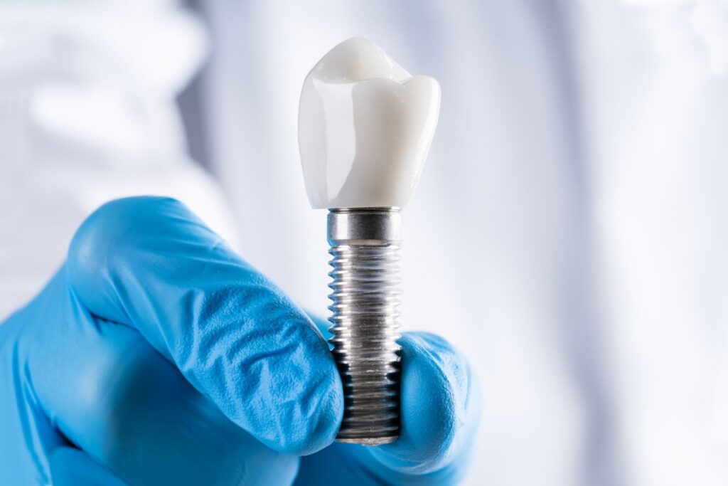 Konya implant tedavisi