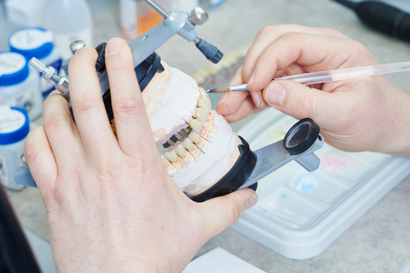 Konya implant üstü protez planlamasında sabit ve hareketli protez değerlendirmesi