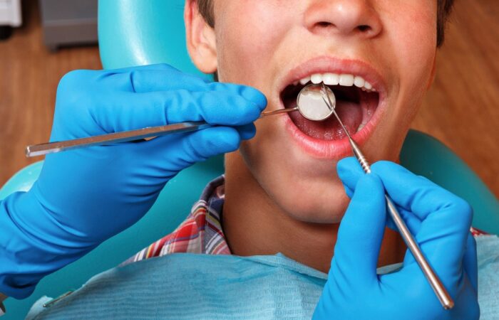 Apikal rezeksiyonda diş kökü ucu ve çevresindeki dokuların cerrahi olarak değerlendirilmesini gösteren dental görsel.