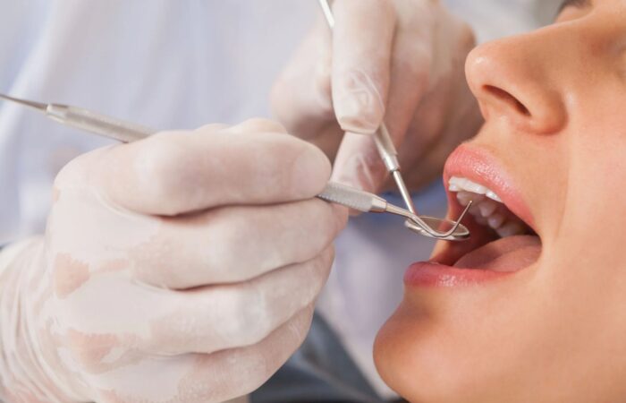 Diş muayenesinde dişlerin, diş etlerinin ve ağız dokularının klinik olarak değerlendirilmesini gösteren dental görsel.