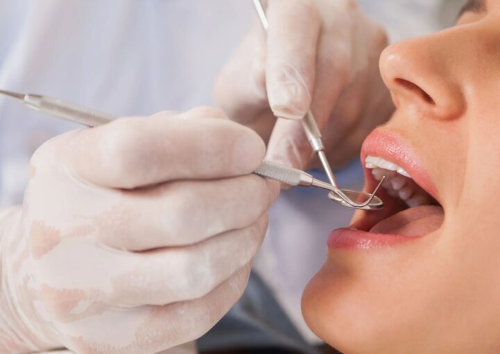Diş muayenesinde dişlerin, diş etlerinin ve ağız dokularının klinik olarak değerlendirilmesini gösteren dental görsel.