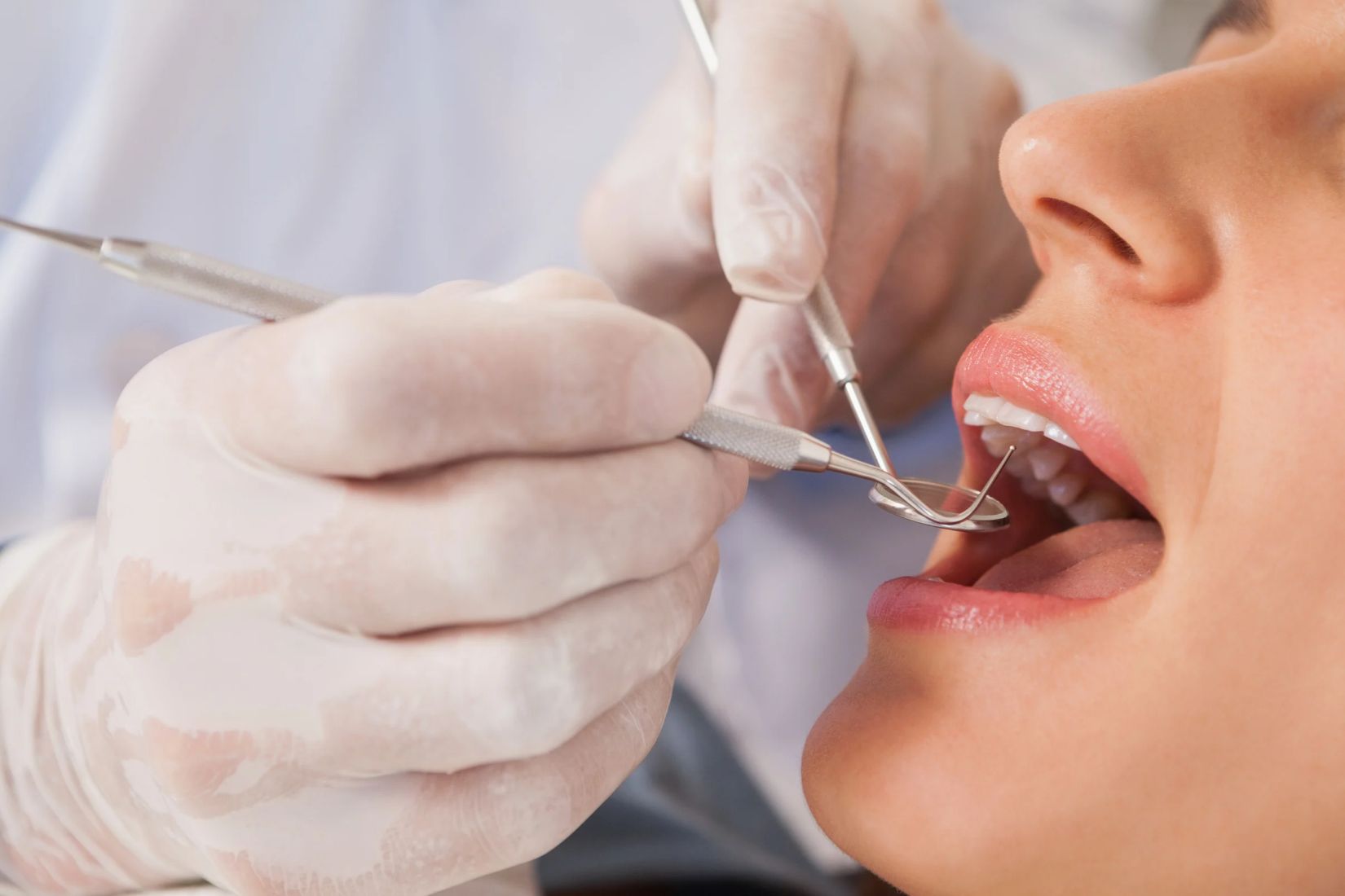 Diş muayenesinde dişlerin, diş etlerinin ve ağız dokularının klinik olarak değerlendirilmesini gösteren dental görsel.