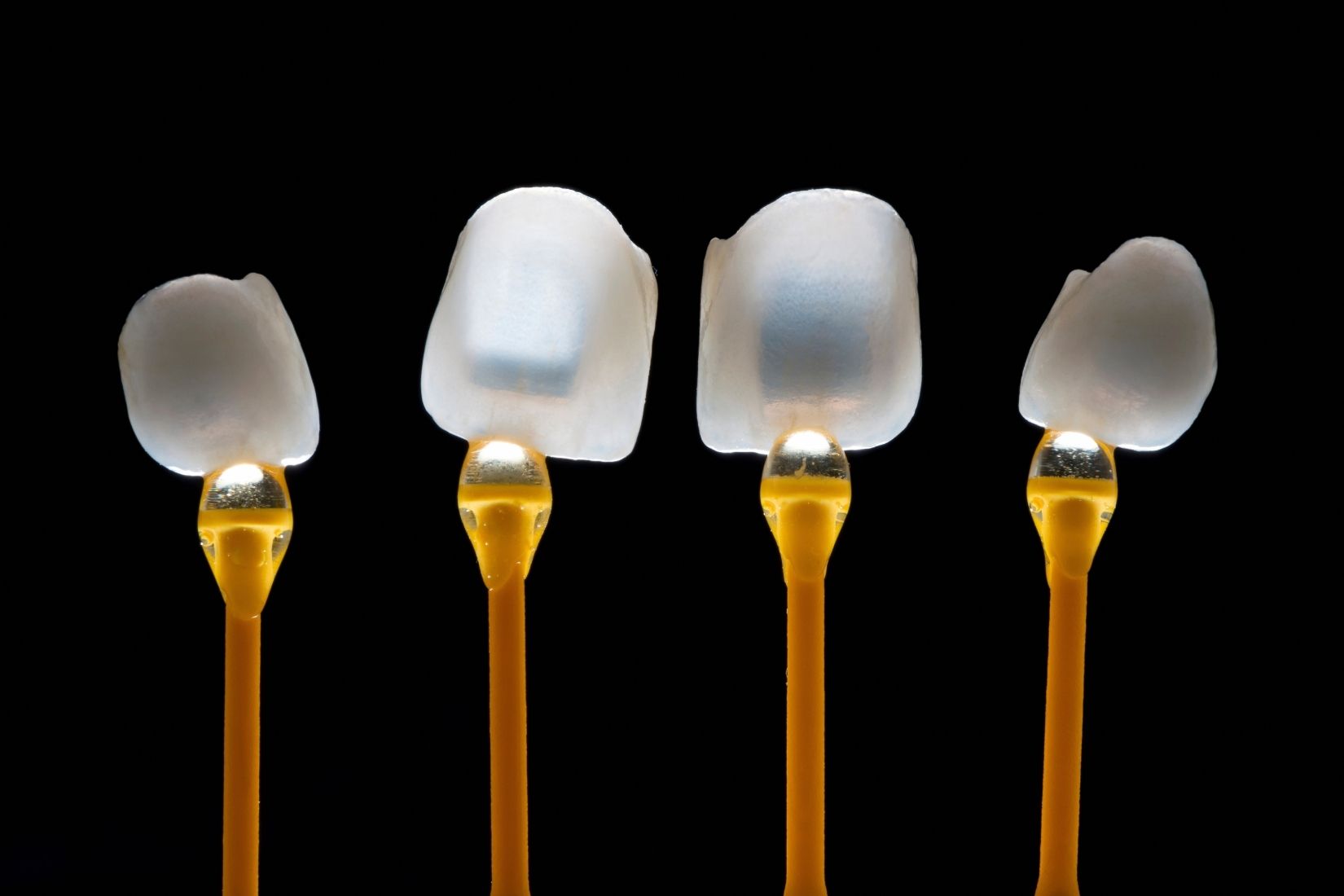 E-Max tam seramik restorasyonla dişin renk, form ve yapısının değerlendirilmesini gösteren bilgilendirici dental görsel.